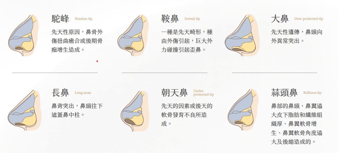 我是塌鼻子嗎？｜鼻型介紹