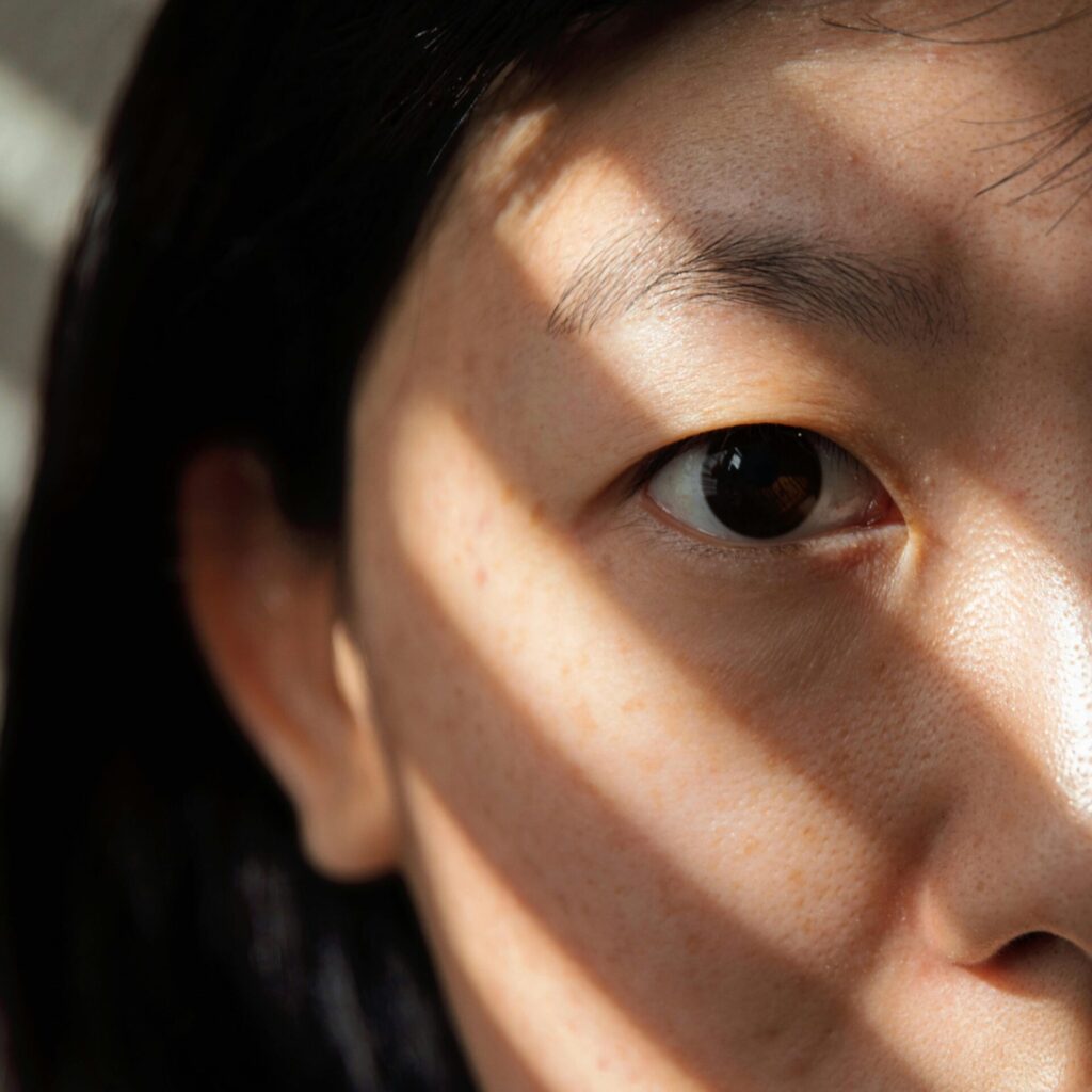 darkcircles
